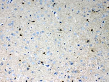 IHC testing of FFPE rat brain tissue with HCN2 antibody at 1ug/ml. Required HIER: steam section in pH6 citrate buffer for 20 min and allow to cool prior to testing.~
