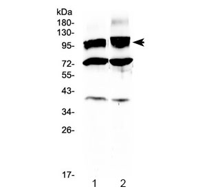 Western blot testing of 1) rat brain and 2) mouse brain lysate with HCN2 antibody