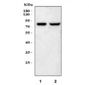 Western blot testing of 1) rat liver and 2) mouse liver lysate with ACSL5 antibody. Predicted molecular weight ~76 kDa.