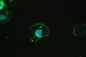 IF/ICC staining of FFPE human A431 cells with Beta Catenin antibody (green) at 2ug/ml and DAPI nuclear stain (blue). Required HIER: steam section in pH6 citrate buffer for 20 min and allow to cool prior to testing.
