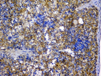 IHC testing of FFPE rat spleen tissue with Beta Catenin antibody at 1ug/ml. Required HIER: steam section in pH6 citrate buffer for 20 min and allow to cool prior to testing.