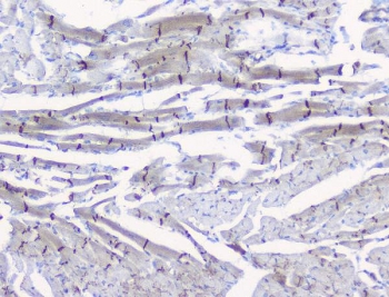IHC testing of FFPE rat heart tissue with Beta Catenin antibody at 1ug/ml. Required HIER: steam section in pH6 citrate buffer for 20 min and allow to cool prior to testing.