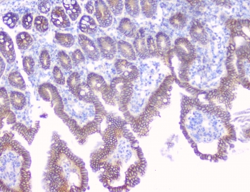 IHC testing of FFPE mouse small intestine tissue with beta Catenin antibody at 1ug/ml. Required HIER: steam section in pH6 citrate buffer for 20 min and allow to cool prior to testing.