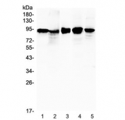 Western blot testing of 1) human placenta, 2) human A431, 3) human SK-OV-3, 4) rat heart and 5) mouse testis lysate with Beta Catenin antibody at 0.5ug/ml. Predicted molecular weight ~85 kDa, but routinely observed at 90-95 kDa.