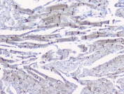 IHC testing of FFPE rat heart tissue with Beta Catenin antibody at 1ug/ml. Required HIER: steam section in pH6 citrate buffer for 20 min and allow to cool prior to testing.