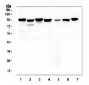 Western blot testing of human 1) placenta, 2) PC-3, 3) U-87 MG, 4) Caco-2, 5) HeLa, 6) A549 and 7) K562 lysate with Beta Catenin antibody at 0.5ug/ml. Predicted molecular weight ~85 kDa, but routinely observed at 90-95 kDa.