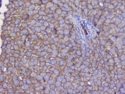 IHC testing of FFPE mouse liver tissue with Beta Catenin antibody at 1ug/ml. Required HIER: steam section in pH6 citrate buffer for 20 min and allow to cool prior to testing.