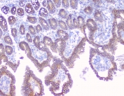 IHC testing of FFPE mouse small intestine tissue with Beta Catenin antibody at 1ug/ml. Required HIER: steam section in pH6 citrate buffer for 20 min and allow to cool prior to testing.