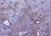 IHC testing of FFPE rat liver tissue with Beta Catenin antibody at 1ug/ml. Required HIER: steam section in pH6 citrate buffer for 20 min and allow to cool prior to testing.