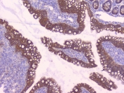 IHC testing of FFPE rat small intestine tissue with Beta Catenin antibody at 1ug/ml. Required HIER: steam section in pH6 citrate buffer for 20 min and allow to cool prior to testing.