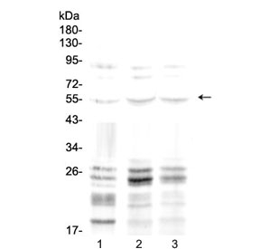 Western blot testing of 1) rat brain, 2) mouse liver and 3) human A549 lysate with PTEN antibody at 0.5ug/ml. Predicted molecular weight: 47~55 kDa (isoform 1), 65~70 kDa ('long' isoform).