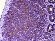IHC testing of FFPE rat lymph tissue with CTLA-4 antibody at 1ug/ml. Required HIER: steam section in pH6 citrate buffer for 20 min and allow to cool prior to testing.