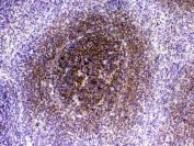 IHC testing of FFPE rat spleen tissue with CTLA-4 antibody at 1ug/ml. Required HIER: steam section in pH6 citrate buffer for 20 min and allow to cool prior to testing.