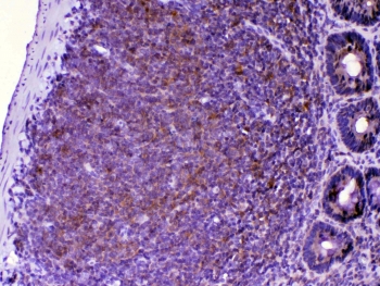 IHC testing of FFPE rat lymph tissue with CTLA-4 antibody at 1ug/ml. Required HIER: steam section in pH6 citrate buffer for 20 min and allow to cool prior to testing.