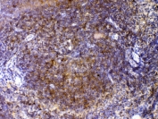 IHC testing of FFPE mouse spleen tissue with CTLA-4 antibody at 1ug/ml. Required HIER: steam section in pH6 citrate buffer for 20 min and allow to cool prior to testing.