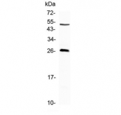 Western blot testing of mouse NIH3T3 cell lysate with CTLA-4 antibody at 0.5ug/ml. Predicted molecular weight: 30-34 kDa (unmodified), 41-43 kDa (glycosylated).