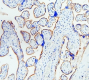 IHC staining of FFPE human placenta with EGFR antibody. HIER: boil tissue sections in pH6, 10mM citrate buffer, for 20 min and allow to cool before testing.