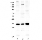 Western blot testing of 1) mouse spleen, 2) mouse testis and 3) rat spleen lysate with MyD88 antibody at 0.5ug/ml. Predicted molecular weight ~33 kDa.