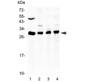 Western blot testing of 1) rat liver, 2) mouse thymus, 3) human MCF7 and 4) human 22RV1 lysate with Bcl-2 antibody at 0.5ug/ml. Predicted molecular weight ~26 kDa.