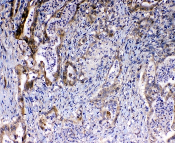 IHC staining of FFPE human intestine with Bcl-2 antibody at 1ug/ml. HIER: boil tissue sections in pH6, 10mM citrate buffer, for 10-20 min and allow to cool before testing.