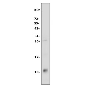 Western blot testing of rat stomach tissue lysate with SDF1 antibody at 0.5ug/ml. Predicted molecular weight