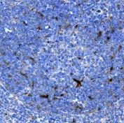 IHC staining of FFPE mouse spleen with SDF1 antibody. HIER: boil tissue sections in pH8 EDTA for 20 min and allow to cool before testing.