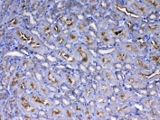 IHC testing of FFPE mouse kidney tissue with IGF1R antibody at 1ug/ml. Required HIER: steam section in pH6 citrate buffer for 20 min and allow to cool prior to testing.