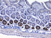 IHC testing of FFPE mouse small intestine tissue with IGF1R antibody at 1ug/ml. Required HIER: steam section in pH6 citrate buffer for 20 min and allow to cool prior to testing.