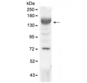 Western blot testing of mouse liver lysate with IGF1R antibody at 0.5ug/ml. Expected molecular weight (glycosylated): ~200 kDa (pro-form), 130-135 kDa (alpha chain).