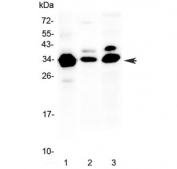 Western blot testing of 1) human COLO320, 2) rat spleen and 3) mouse NIH3T3 lysate with IL-1 beta antibody at 0.5ug/ml. Predicted molecular weight ~31 kDa.