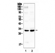 Western blot testing of 1) rat brain and 2) mouse spleen lysate with IL1B antibody at 0.5ug/ml. Predicted molecular weight ~31 kDa.