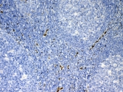 IHC testing of FFPE human tonsil tissue with IL-33 antibody at 1ug/ml. Required HIER: steam section in pH6 citrate buffer for 20 min and allow to cool prior to testing.