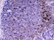 IHC testing of FFPE rat lymph tissue with Cd14 antibody at 1ug/ml. Required HIER: steam section in pH6 citrate buffer for 20 min and allow to cool prior to testing.