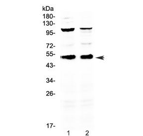 Western blot testing of 1) mouse thymus and 2) mouse spleen with CD14 antibody at 0.5ug/ml. Predicted molecular weight ~40 kDa (unmodified) and 50-55 kDa (glycosylated).