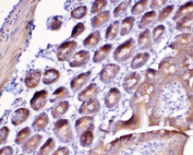 IHC testing of FFPE mouse small intestine tissue with Flt3 antibody at 1ug/ml. Required HIER: steam section in pH6 citrate buffer for 20 min and allow to cool prior to testing.