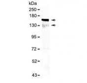Western blot testing of mouse brain lysate with Flt3 antibody at 0.5ug/ml. Predicted molecular weight: ~113 kDa (unmodified), ~130/160 kDa (glycosylated).