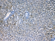 IHC testing of FFPE rat liver tissue with Flt3 antibody at 1ug/ml. Required HIER: steam section in pH6 citrate buffer for 20 min and allow to cool prior to testing.