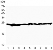 Western blot testing of 1) rat brain, 2) rat testis, 3) rat thymus, 4) mouse brain, 5) mouse testis, 6) mouse thymus, 7) human A549, 8) human 22RV1 and 9) human HeLa lysate with RAN antibody at 0.5ug/ml. Predicted molecular weight ~25 kDa.