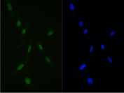 IF/ICC staining of FFPE human U-2 OS cells with RAN antibody (green) at 2ug/ml and DAPI nuclear stain (blue). HIER: steam section in pH6 citrate buffer for 20 min.