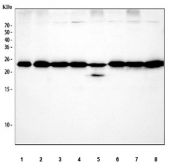 Western blot testing of 1) human PC-3, 2) human RT4, 3) human A549, 4) human Caco-2, 5) rat thymus, 6) rat PC-12, 7) mouse thymus and 8) mouse A20 cell lysate with RAN antibody at 0.5ug/ml. Predicted molecular weight ~25 kDa.
