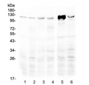 Western blot testing of 1) rat spleen, 2) rat thymus, 3) mouse spleen, 4) mouse thymus, 5) mouse NIH3T3 and 6) human Jurkat lysate with RIG-I antibody at 0.5ug/ml. Expected molecular weight: 106-115 kDa.
