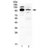 Western blot testing of 1) mouse thymus and 2) human 22RV1 lysate with NFAT2 antibody at 0.5ug/ml. Predicted molecular weight: ~77 kDa (isoform A), ~88 kDa (isoform B), ~101 kDa (isoform C).