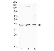 Western blot testing of human 1) MCF7, 2) SK-OV-3 and 3) PANC-1 cell lysate with CD47 antibody at 0.5ug/ml. Predicted molecular weight: 35~60 kDa depending on glycosylation level.