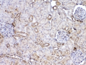 IHC testing of FFPE rat kidney tissue with GST pi antibody at 1ug/ml. Required HIER: steam section in pH6 citrate buffer for 20 min and allow to cool prior to testing.