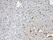 IHC testing of FFPE rat liver tissue with GST pi antibody at 1ug/ml. Required HIER: steam section in pH6 citrate buffer for 20 min and allow to cool prior to testing.