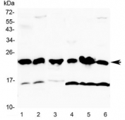 Western blot testing of 1) mouse lung, 2) mouse testis, 3) rat spleen 4) human A549, 5) human placenta and 6) human HeLa lysate with GST pi antibody at 0.5ug/ml. Predicted molecular weight ~23 kDa.