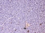 IHC testing of FFPE rat liver tissue with GSTP1 antibody at 1ug/ml. Required HIER: steam section in pH6 citrate buffer for 20 min and allow to cool prior to testing.