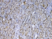 IHC testing of FFPE rat kidney tissue with GSTP1 antibody at 1ug/ml. Required HIER: steam section in pH6 citrate buffer for 20 min and allow to cool prior to testing.