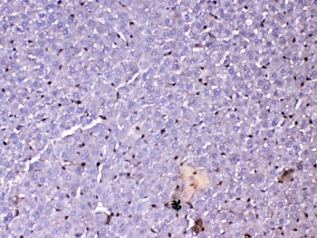 IHC testing of FFPE rat liver tissue with GSTP1 antibody at 1ug/ml. Required HIER: steam section in pH6 citrate buffer for 20 min and allow to cool prior to testing.