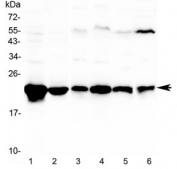Western blot testing of 1) rat lung, 2) rat liver, 3) mouse lung, 4) mouse liver, 5) mouse spleen and 6) human HeLa lysate with GSTP1 antibody at 0.5ug/ml. Predicted molecular weight ~23 kDa.